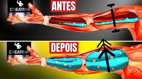 Efeitos Do Hipertireoidismo Nos Níveis De Creatina